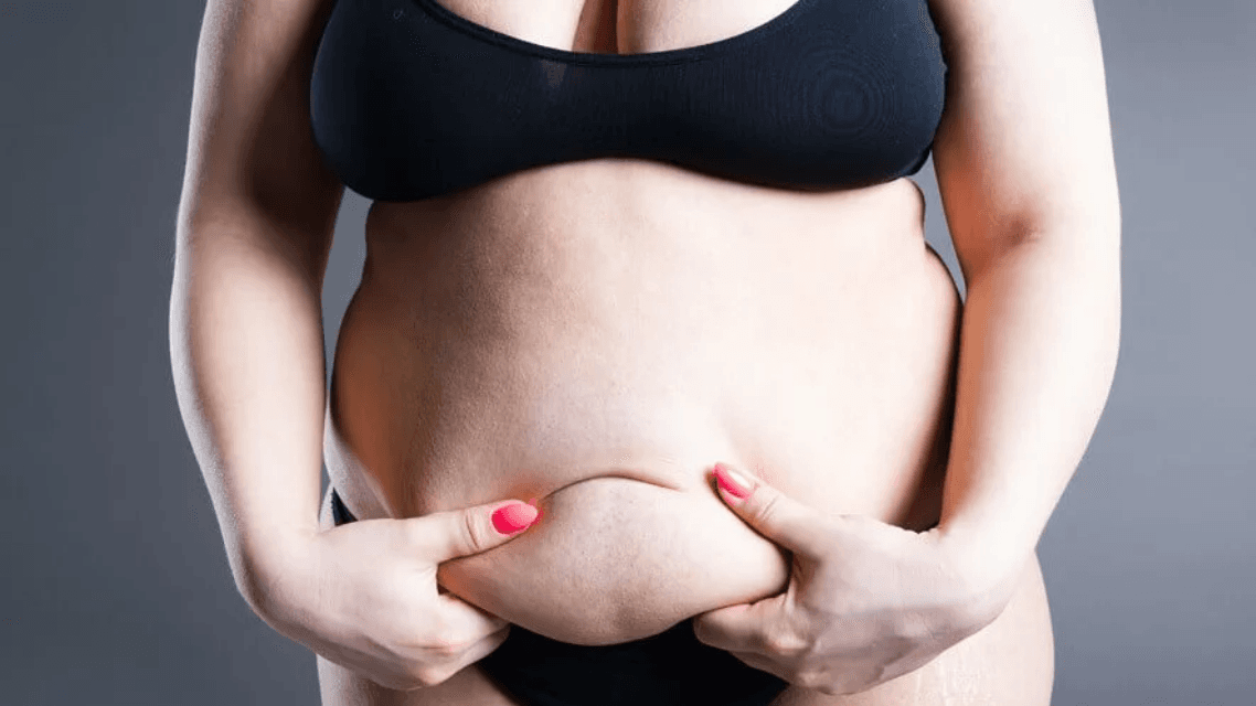 Lipödem-Behandlung: Von manueller Lymphdrainage bis zur Liposuktion
