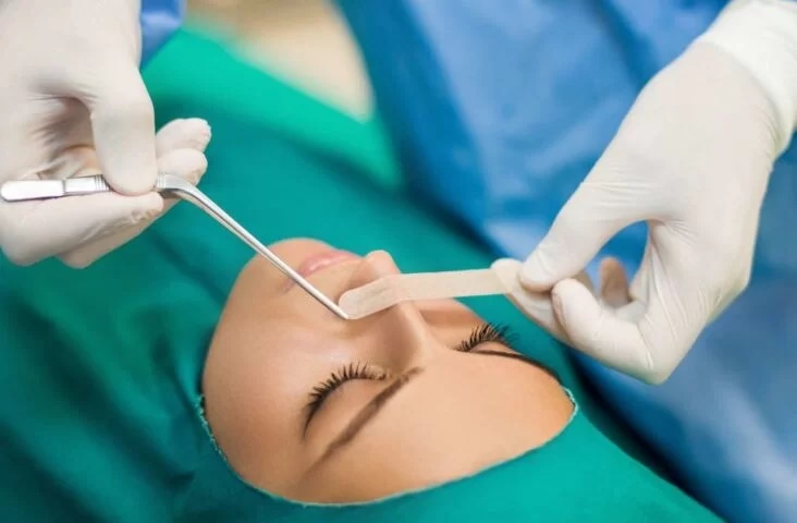 Die ideale Lebensweise nach einer Nasenkorrektur-Operation