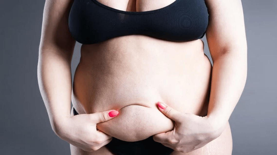 Lipödem-Behandlung: Von manueller Lymphdrainage bis zur Liposuktion