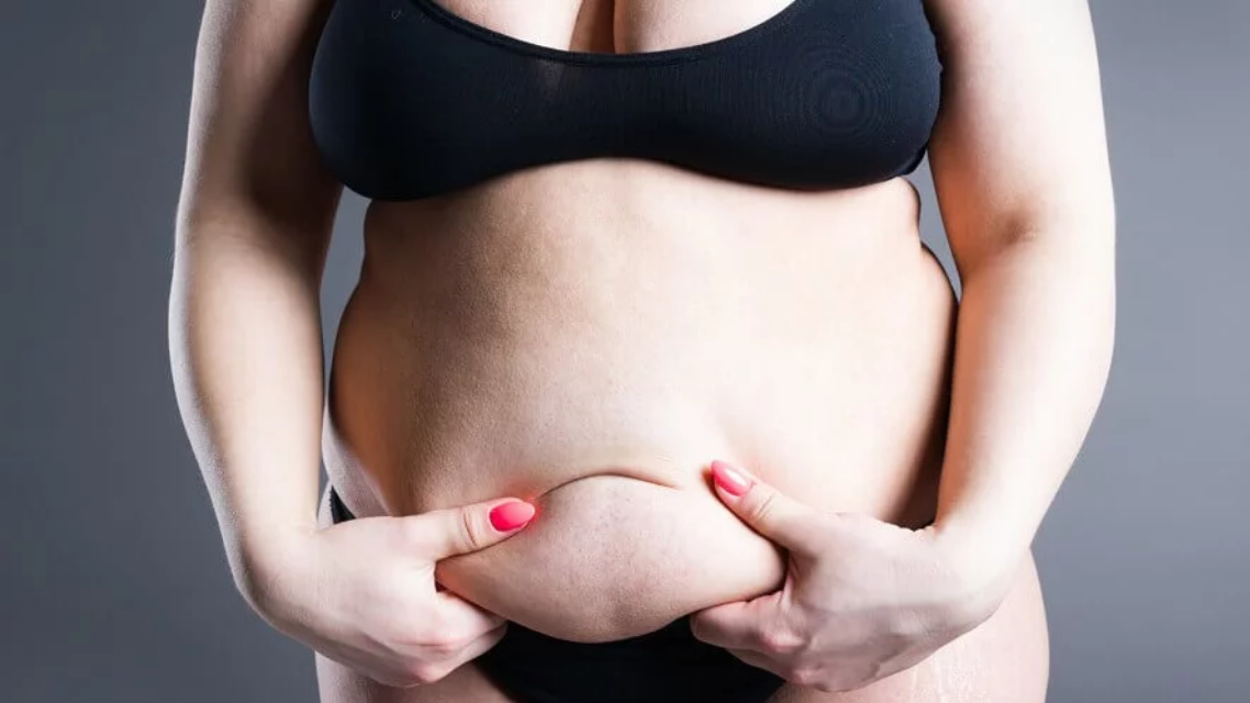 Lipödem-Behandlung: Von manueller Lymphdrainage bis zur Liposuktion
